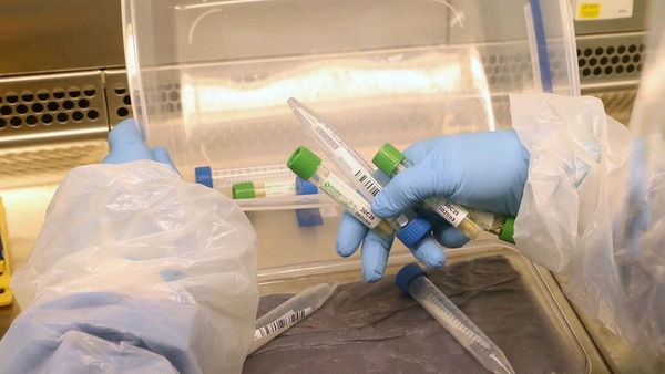 Damien McCallion said positive cases will be routed to the National Virus Reference Laboratory for further testing