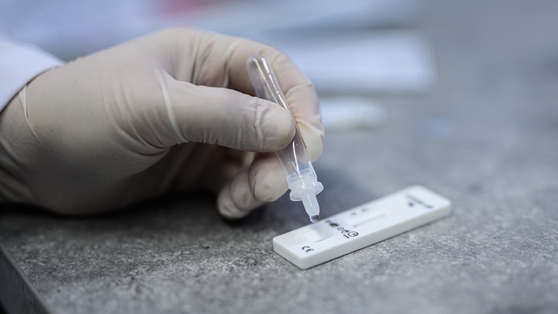 Northern Ireland's Department of Health said the move is in line with the Test, Trace and Protect Transition plan published in March