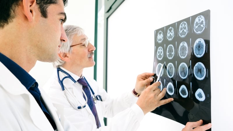 The global Interstroke study, the largest research project of its kind, was co-led by NUI Galway (Posed stock image)