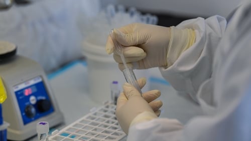 Excess death figures include those who died from Covid-19 without having been tested as well as from other illnesses (File image)
