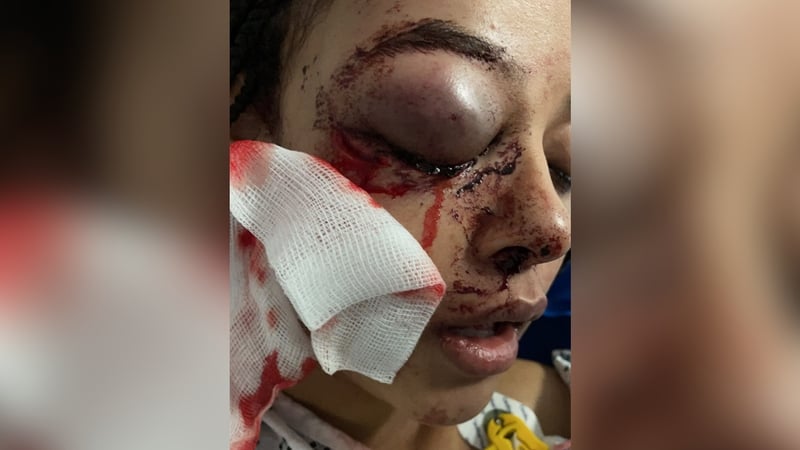 Alanna Quinn Idris, 17, was treated for her injuries in hospital