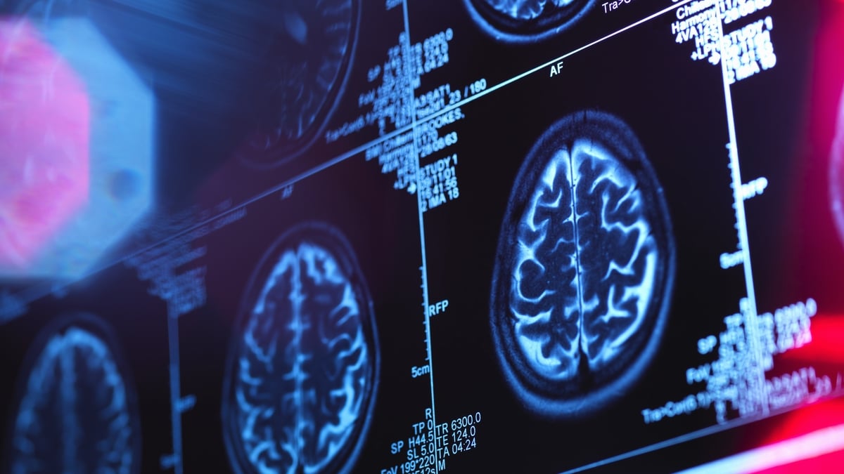 Knowing the risks for dementia