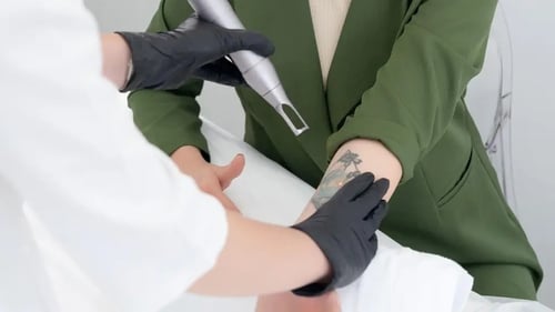 Experts explain how the ink-zapping method works. By Katie Wright.