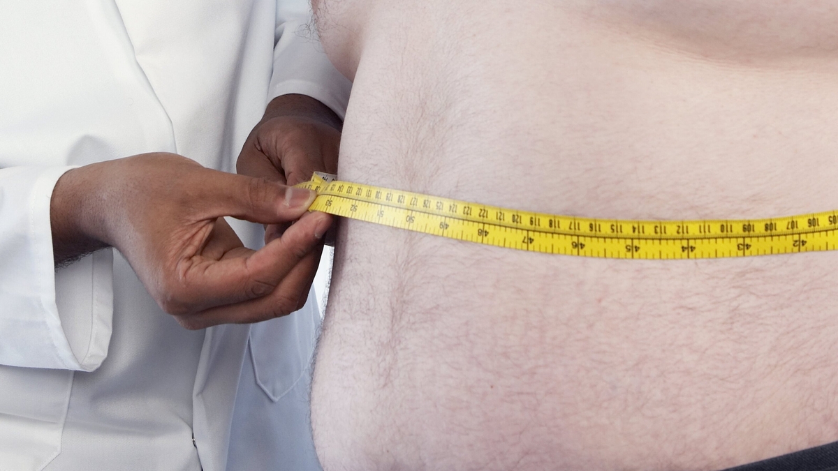More than one billion people in the world are now living with obesity