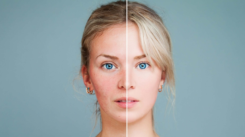 Prudence Wade finds out how anti-inflammatory products work, and what ingredients we should be looking out for.