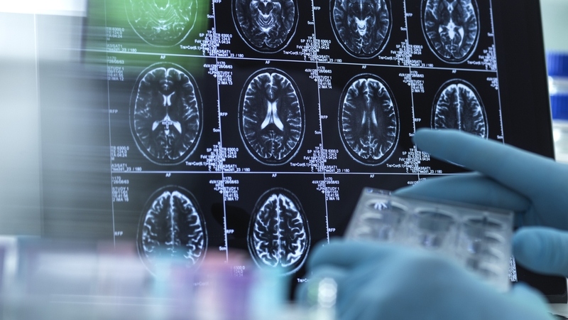 There are 800,000 people in Ireland with a neurological condition (stock image)