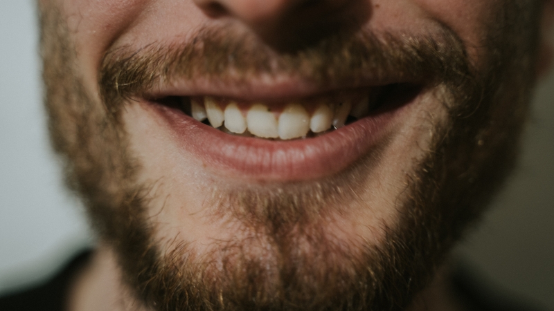 A full beard is advised rather than one resembling a 'badly watered lawn in a heatwave' (file image)