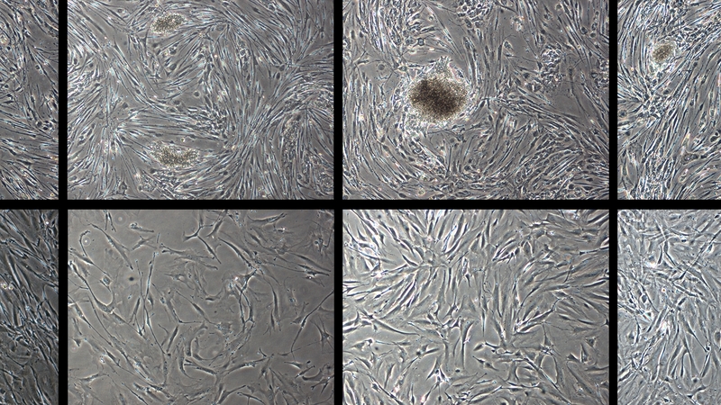 Microscopic image of a human skin cells temporarily changing shape