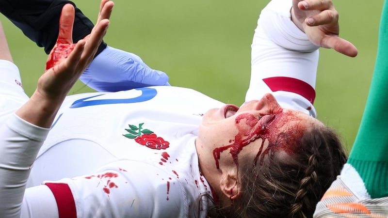 Jess Breach did not return from her head injury assessment