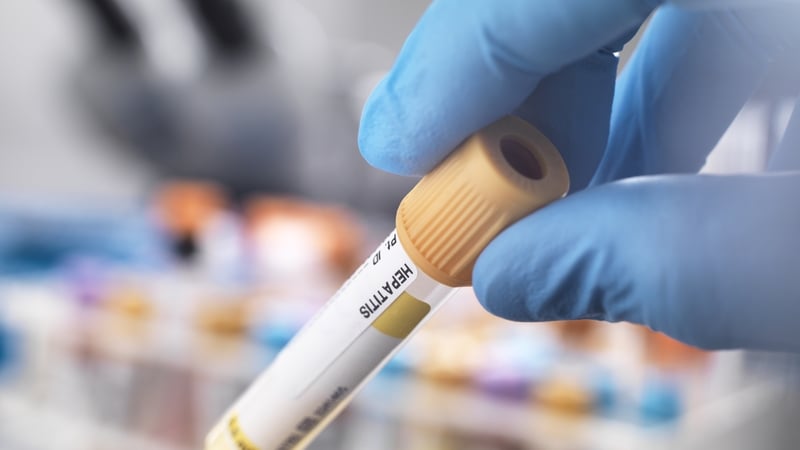 Indonesia's Health Ministry said that three children had died in hospitals in the capital Jakarta last month, after displaying some of these symptoms