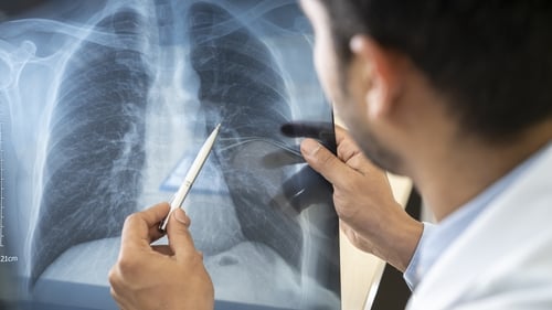 The WHO has estimated the full death toll associated directly or indirectly with the Covid-19 pandemic