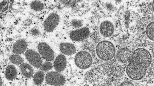 The monkeypox virus has been reported in the US and Canada, as well as Eutrope