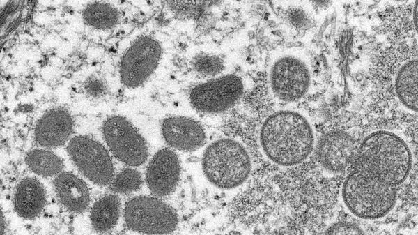The monkeypox virus has been reported in the US and Canada, as well as Eutrope