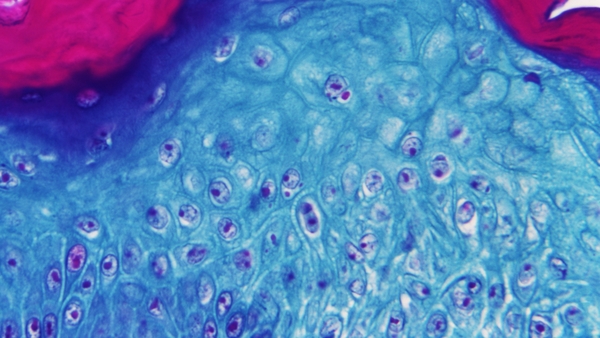 Four additional cases have been reported in the last week