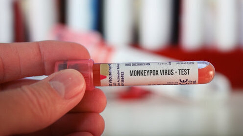 Global health officials have sounded the alarm over rising cases of the monkeypox in Europe and elsewhere