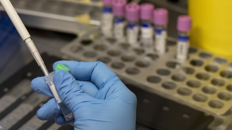 KDCA raised its alert level for infectious diseases