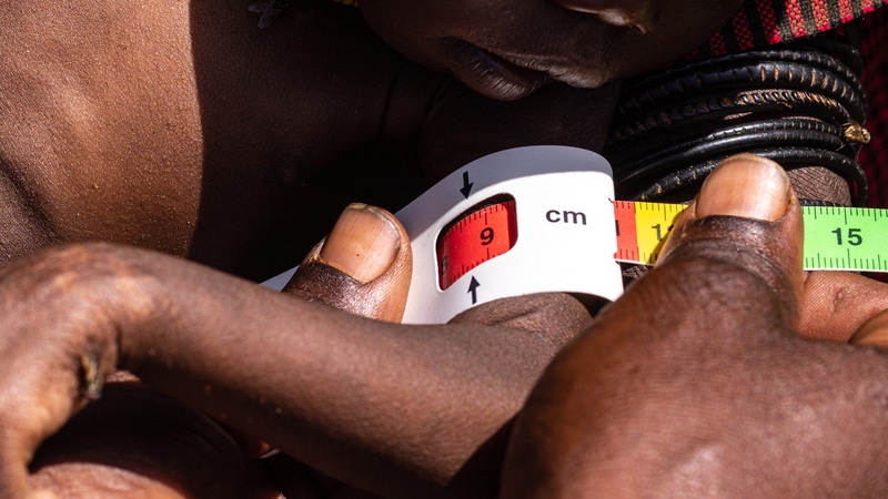 The circumference of a boy's arm is measured during a nutrition screening in Lomusian, Karamoja region, Uganda