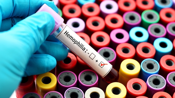 Haemophilia is a rare condition that affects the blood's ability to clot (stock image)