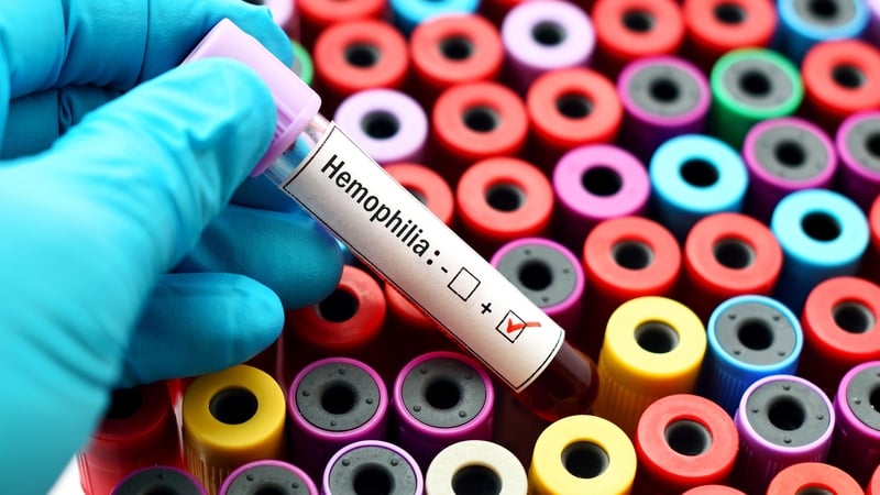 Haemophilia is a rare condition that affects the blood's ability to clot (stock image)