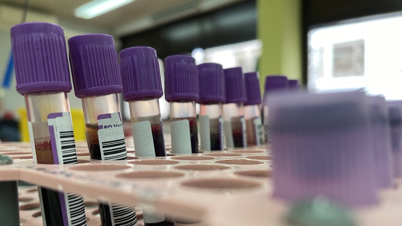 Trial hopes to assess effectiveness of antiviral drugs (stock image)