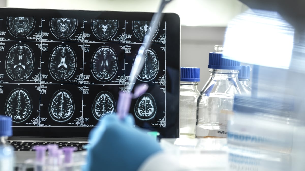 Prof Luke O’Neill: How dementia could be linked to your ageing immune system