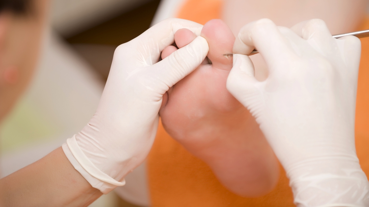 Chiropody Service Shortage