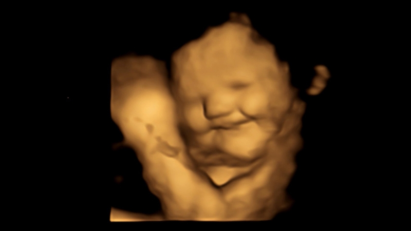 A study of 100 foetuses saw babies in the womb smile for carrot flavours but...