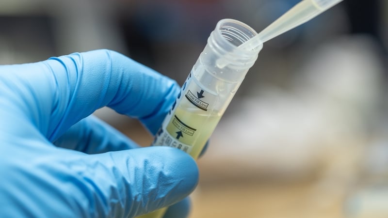 Doctors have urged people to avail of testing for Chlamydia and Gonorrhoea amid the uptick in cases (file image)