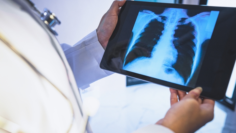 Breast cancer made up the largest proportion of cases in those aged under 50