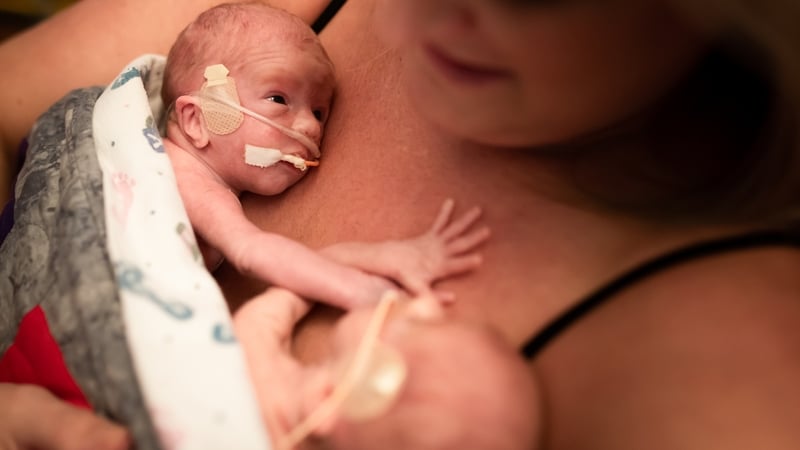 Premature twins are held by their mother in this file photo