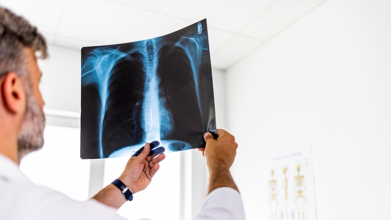 An líon daoine a tháinig slán ó ailse ardaithe 50% le deich mbliana