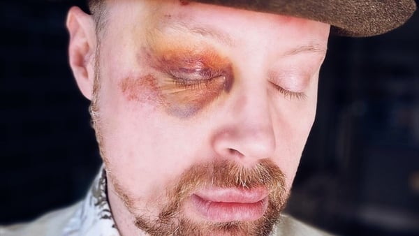 David Babington was the victim of a recent homophobic assault in Cork.