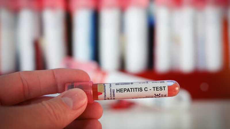 The HSE provides free online testing for Hepatitis C