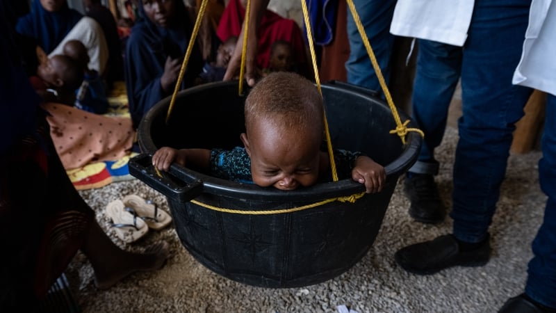 A malnourished Somali baby girl cries while being weighed at a health center, as Somalis struggle to cope with famine conditions