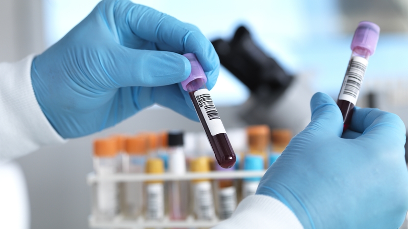 Overall, the test correctly revealed cancer 66% of the time (Stock image)