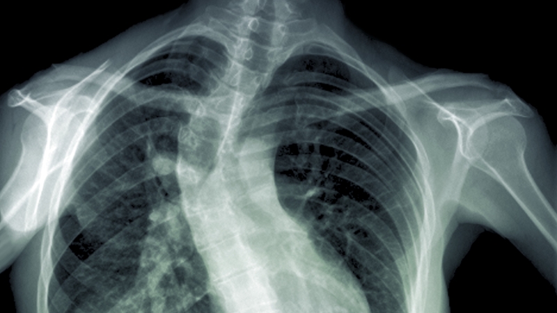 Families who elect to travel are expected to have their flights and accommodation paid for by the Department of Health