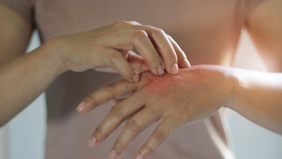 Body Focused Repetitive Behaviour