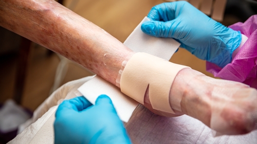 EB patients received no additional funding in Budget 2024, for the second year in a row (file image)