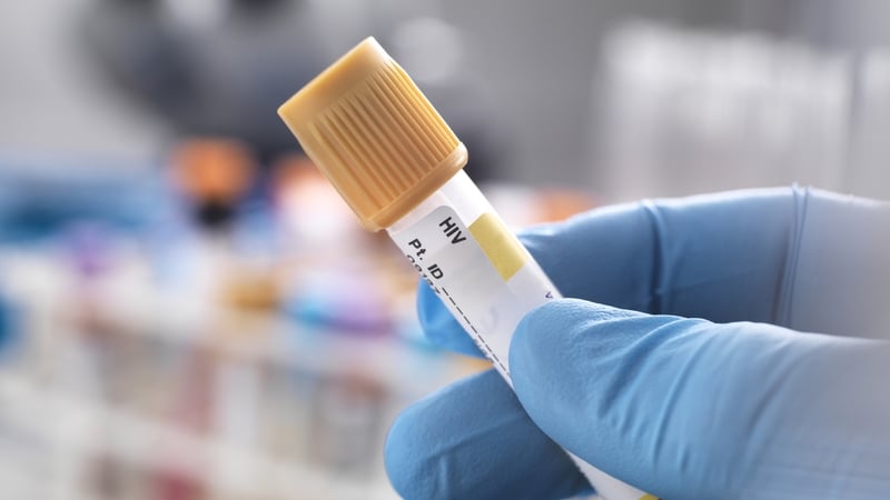 A HPSC report showed there 884 cases of HIV in Ireland last year