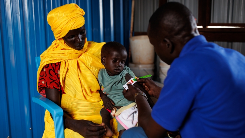 A young boy with severe malnutrition is examined at a clinic in Rotriak, South Sudan