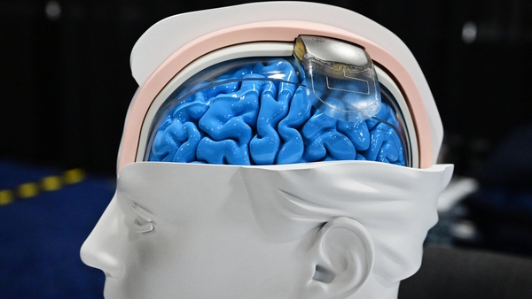 Wimagine, the brain implant designed by France's Atomic Energy Commission, should enable paralysed people to walk again