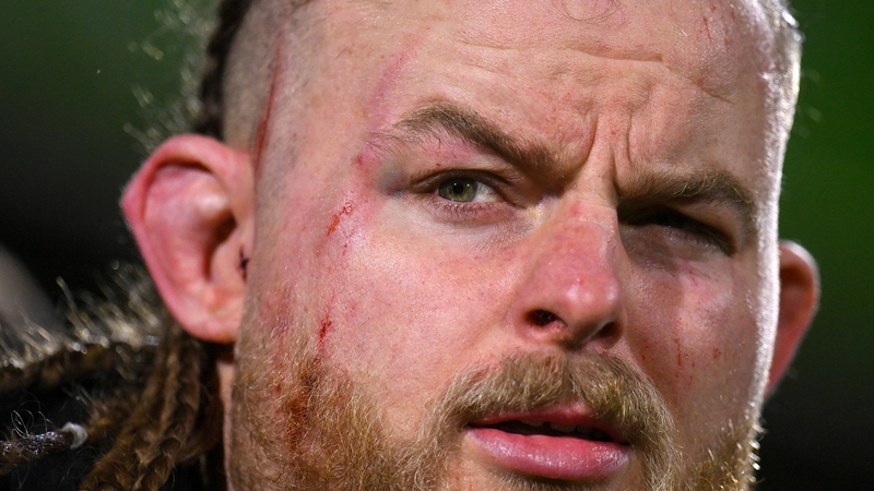 Finlay Bealham took a boot to the head