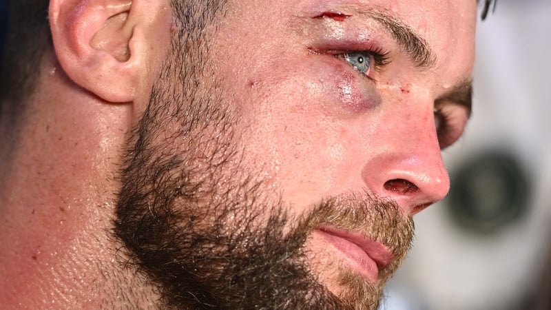 Padraig McCrory had described the Berlanga fight as the biggest of his career to date