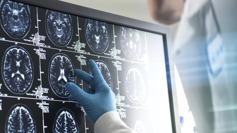 The findings follow an analysis of the experiences of 1,329 women, to examine the association between reproductive factors and how the brain ages (stock pic)