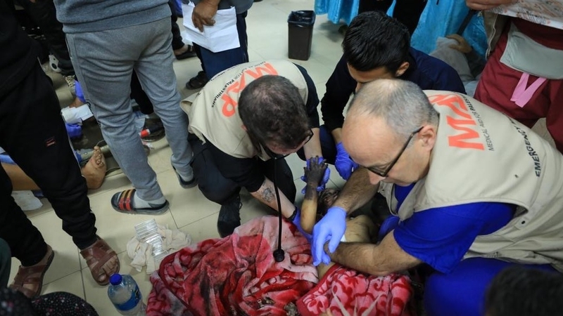 Prof Nick Maynard (R) treats an injured child at Al Aqsa Hospital, Gaza, in January