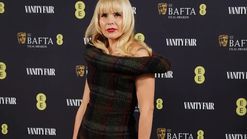Singer Paloma Faith opens up about her stress-related hair loss (Ian West/PA)