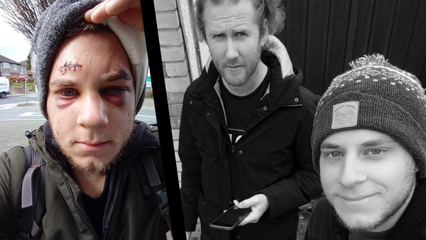 (L) David Druzinec after the attack. (R) Josip Strok and David Druzinec in Ireland together.