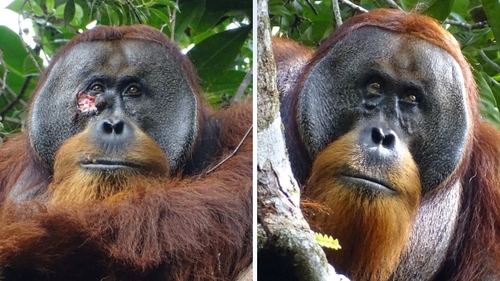 The wound before and after the treatment