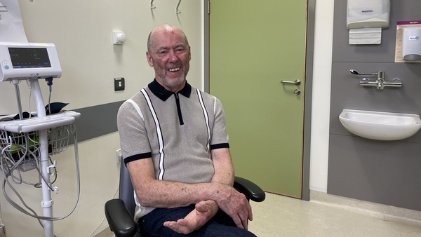 Andy Kavanagh was just 19 when he underwent the surgery in 1986 at Dublin's Mater Hospital