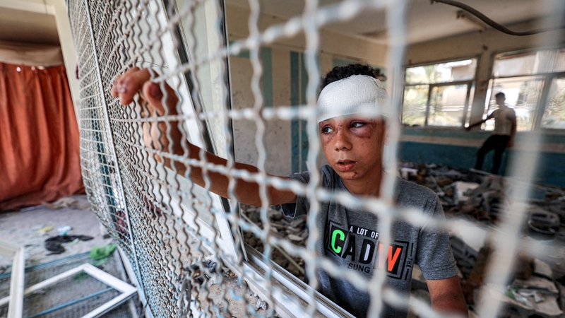 An injured boy at a school run by the UN Relief and Works Agency for Palestine Refugees destroyed by Israeli bombardment in Nuseirat, central Gaza